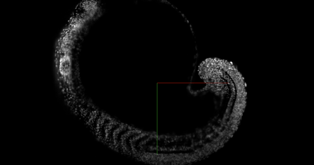 Zebrafish embryo imaged with DaXi light-sheet microscope